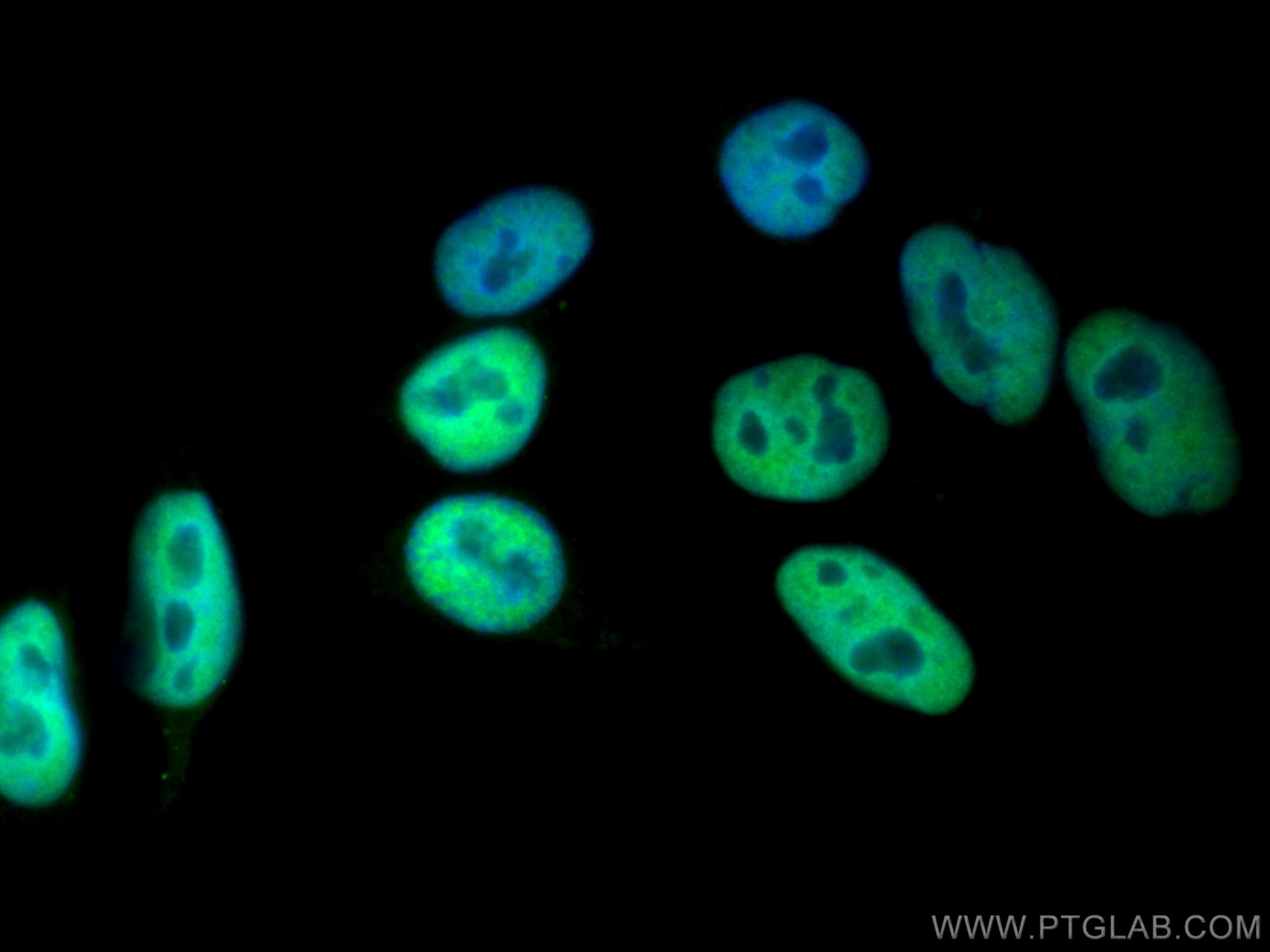 Immunofluorescence (IF) / fluorescent staining of HepG2 cells using CoraLite® Plus 488-conjugated HDAC2 Polyclonal ant (CL488-12922)