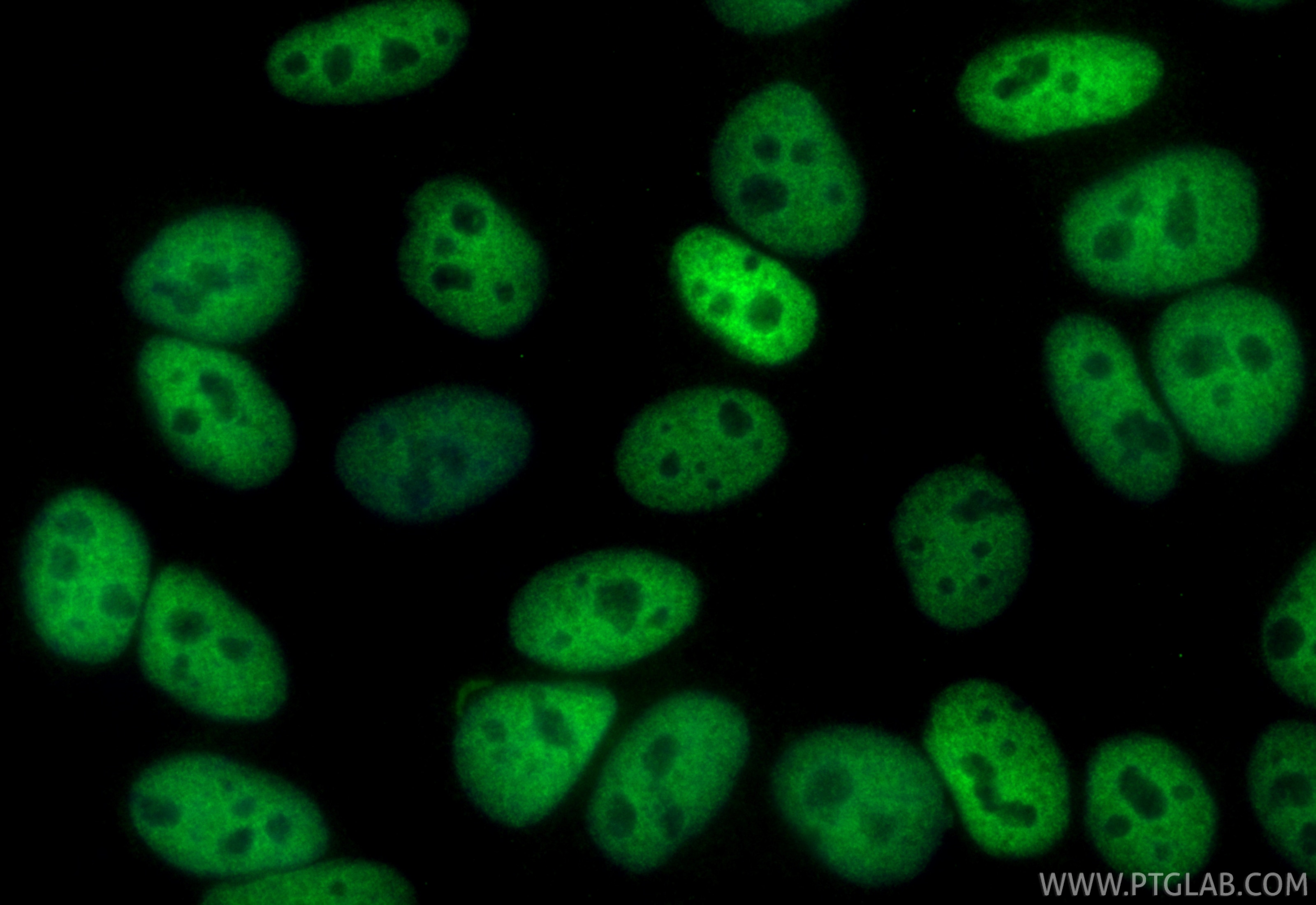 Immunofluorescence (IF) / fluorescent staining of HepG2 cells using CoraLite® Plus 488-conjugated HDAC2 Monoclonal ant (CL488-67165)