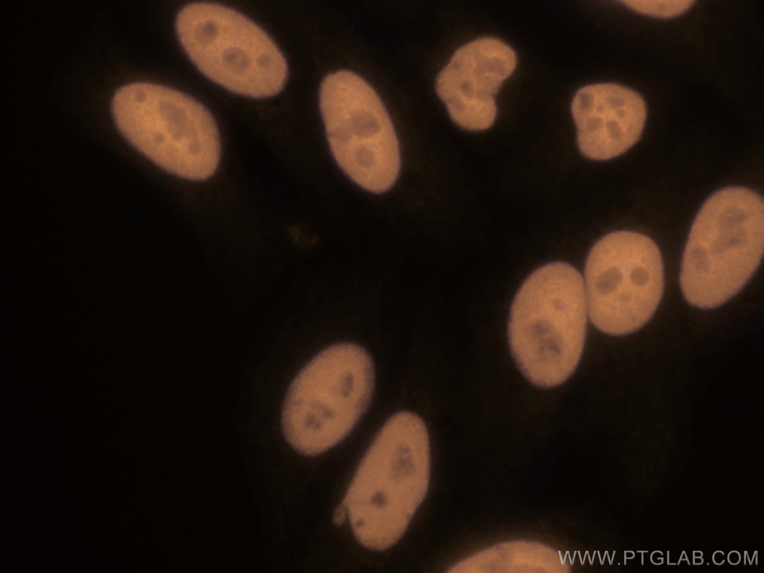 Immunofluorescence (IF) / fluorescent staining of HepG2 cells using CoraLite®555-conjugated HDAC2 Polyclonal antibody (CL555-12922)