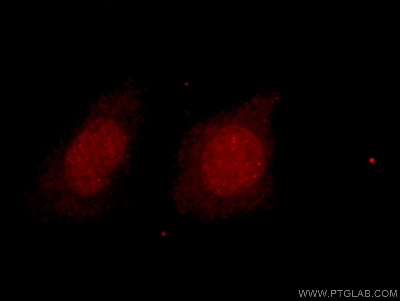 Immunofluorescence (IF) / fluorescent staining of HeLa cells using HDAC2-specific Polyclonal antibody (16152-1-AP)