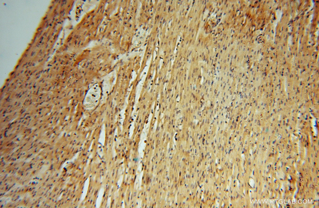 Immunohistochemistry (IHC) staining of human heart tissue using HDAC2-specific Polyclonal antibody (16152-1-AP)