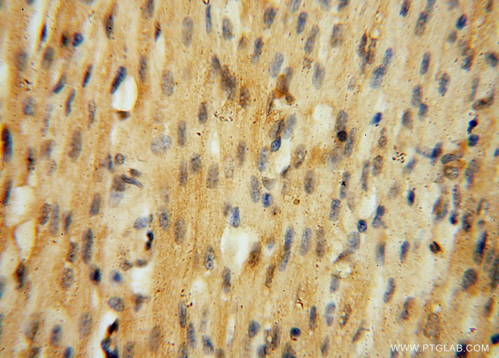 IHC staining of human heart using 16152-1-AP