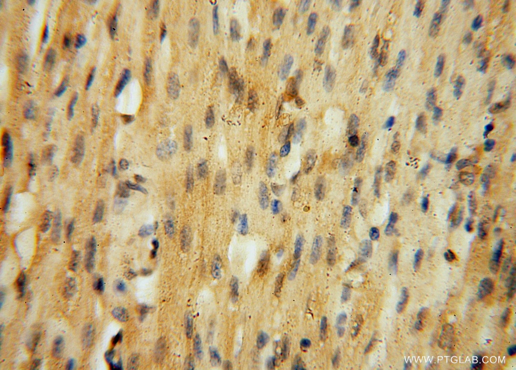 Immunohistochemistry (IHC) staining of human heart tissue using HDAC2-specific Polyclonal antibody (16152-1-AP)