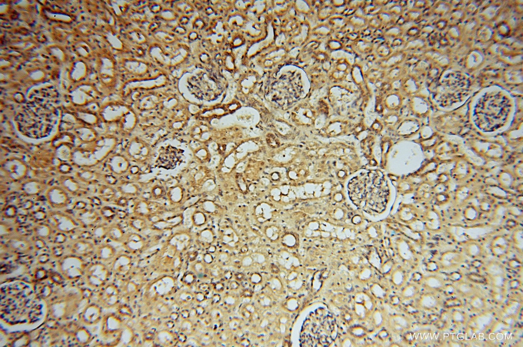 IHC staining of human kidney using 16152-1-AP
