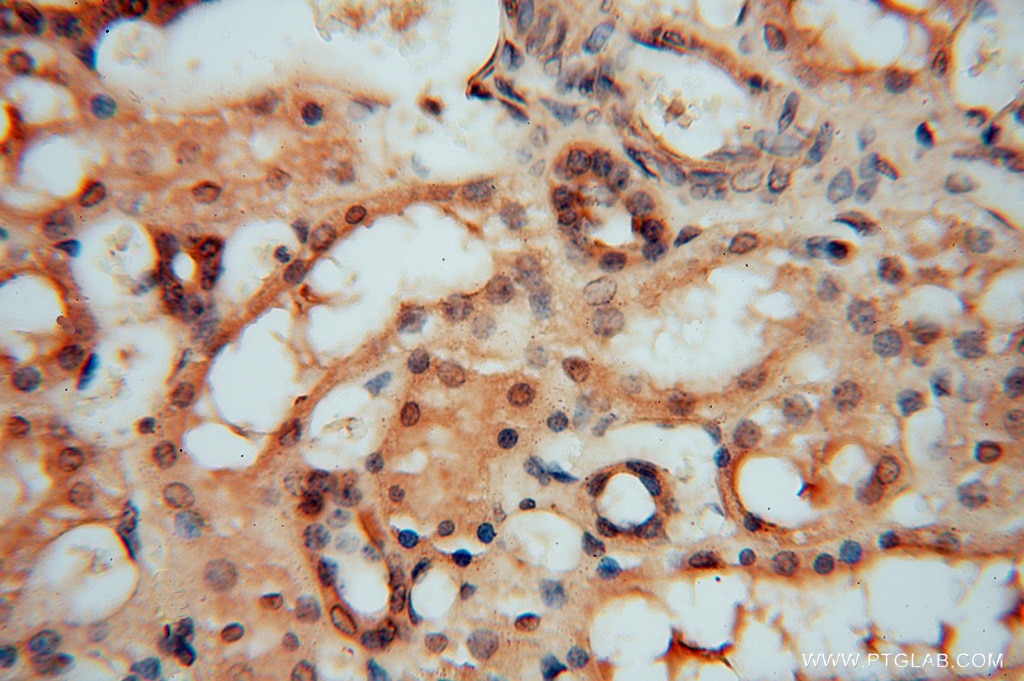 Immunohistochemistry (IHC) staining of human kidney tissue using HDAC2-specific Polyclonal antibody (16152-1-AP)