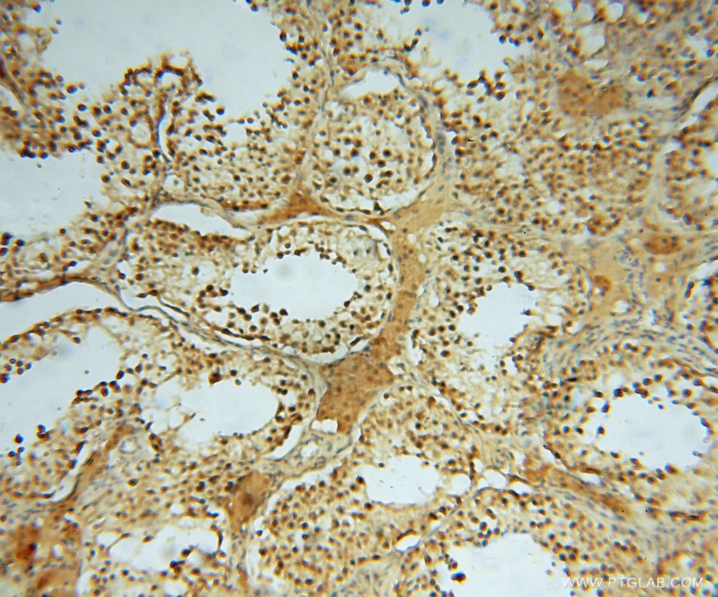Immunohistochemistry (IHC) staining of human testis tissue using HDAC2-specific Polyclonal antibody (16152-1-AP)