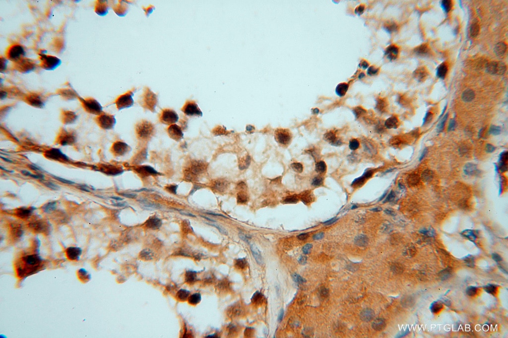 Immunohistochemistry (IHC) staining of human testis tissue using HDAC2-specific Polyclonal antibody (16152-1-AP)