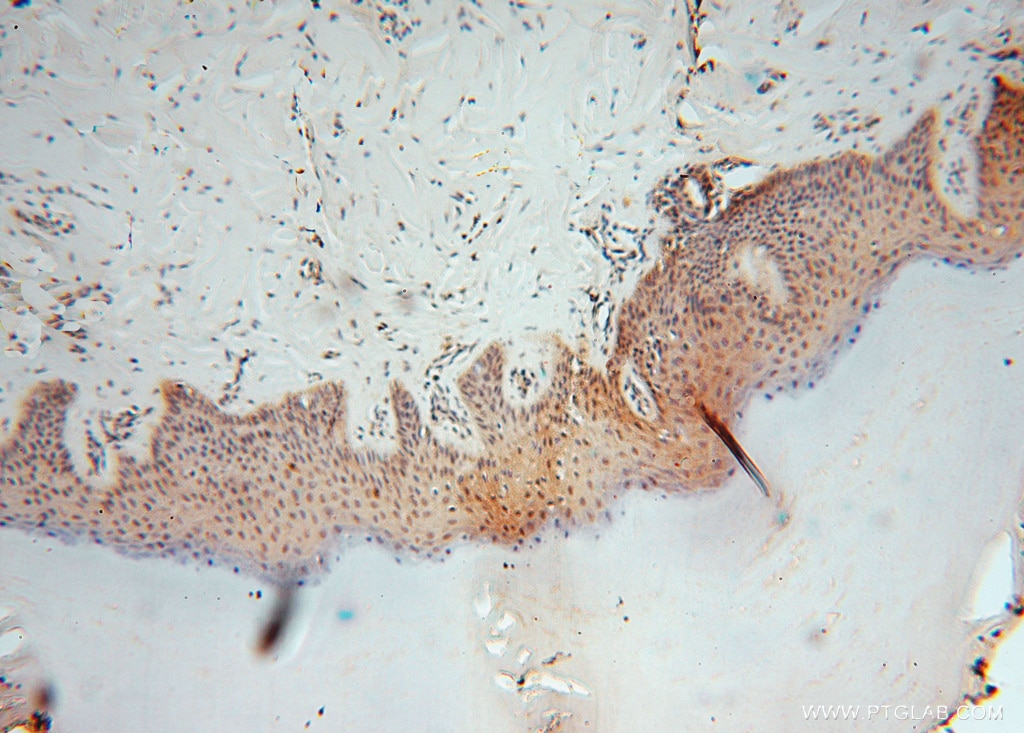 IHC staining of human skin using 16152-1-AP