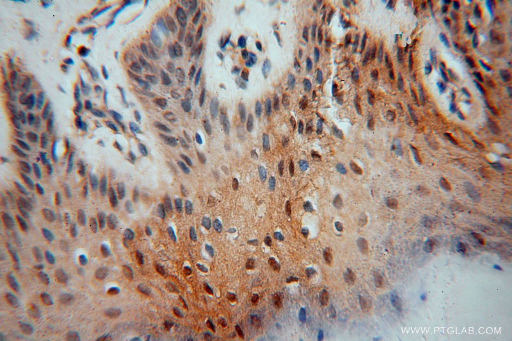 Immunohistochemistry (IHC) staining of human skin tissue using HDAC2-specific Polyclonal antibody (16152-1-AP)