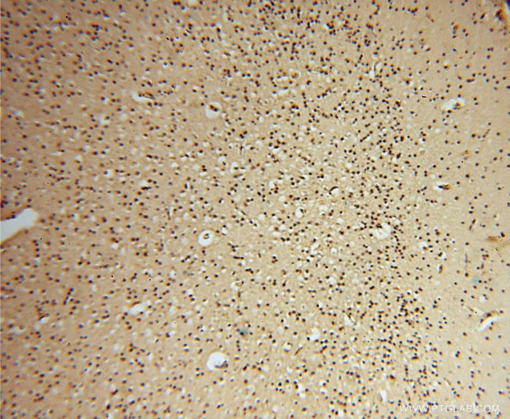 Immunohistochemistry (IHC) staining of human brain tissue using HDAC2-specific Polyclonal antibody (16152-1-AP)