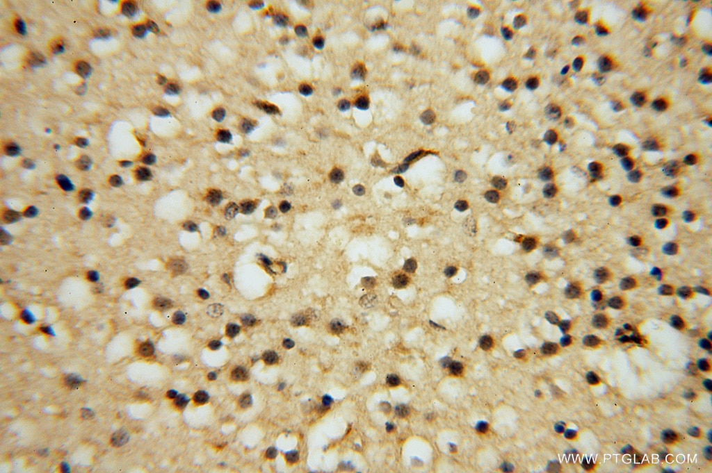 Immunohistochemistry (IHC) staining of human brain tissue using HDAC2-specific Polyclonal antibody (16152-1-AP)