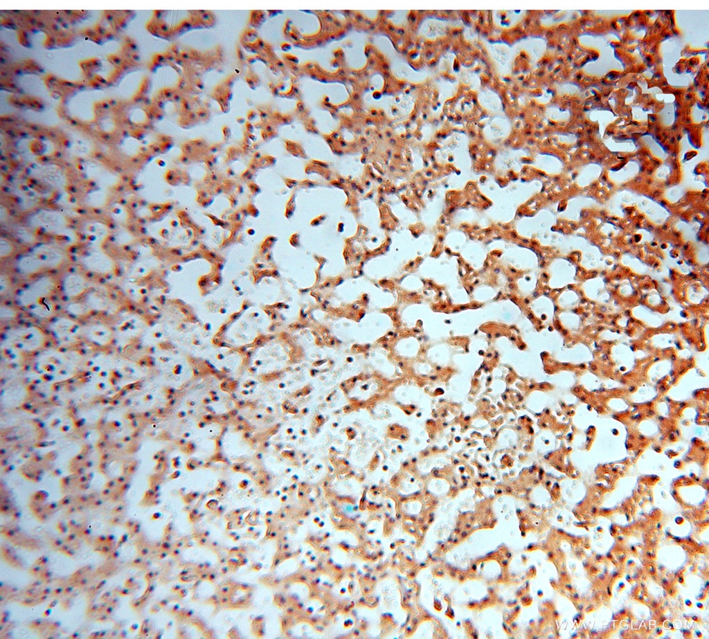 Immunohistochemistry (IHC) staining of human liver tissue using HDAC2-specific Polyclonal antibody (16152-1-AP)