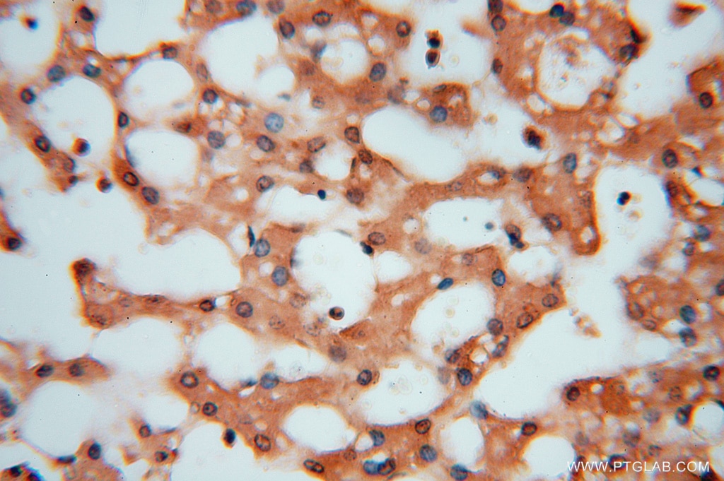 Immunohistochemistry (IHC) staining of human liver tissue using HDAC2-specific Polyclonal antibody (16152-1-AP)