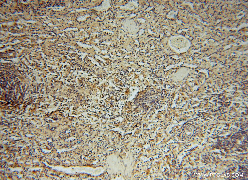 Immunohistochemistry (IHC) staining of human spleen tissue using HDAC2-specific Polyclonal antibody (16152-1-AP)