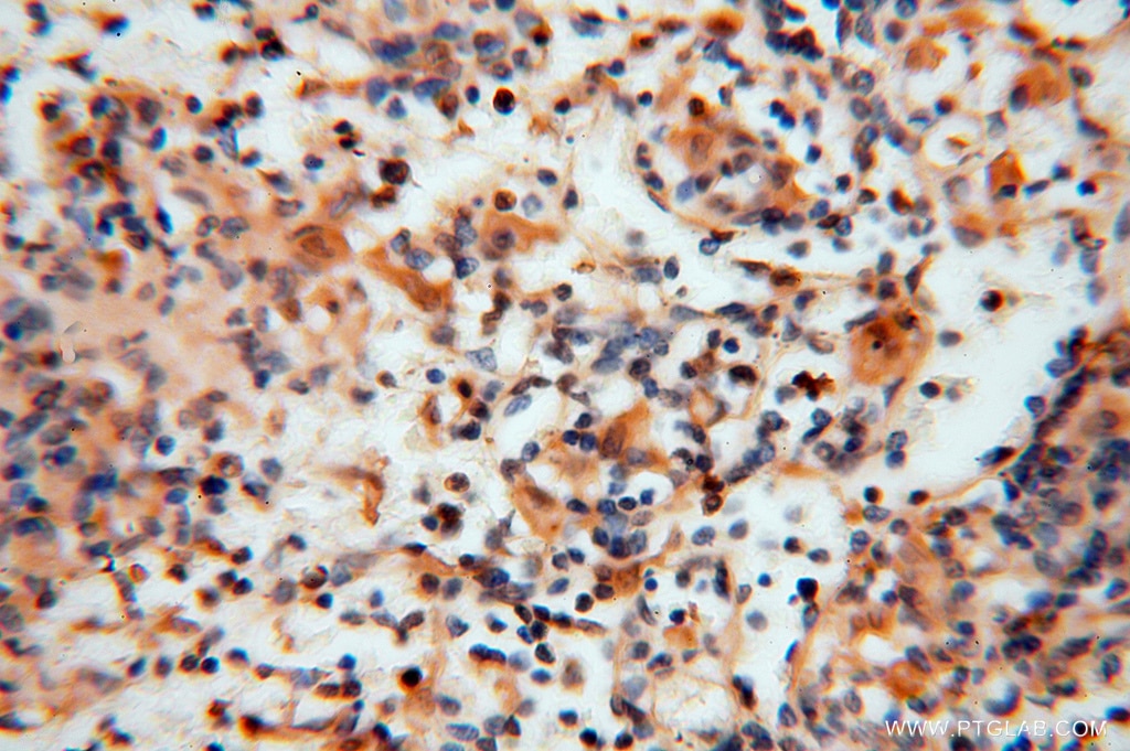 Immunohistochemistry (IHC) staining of human spleen tissue using HDAC2-specific Polyclonal antibody (16152-1-AP)