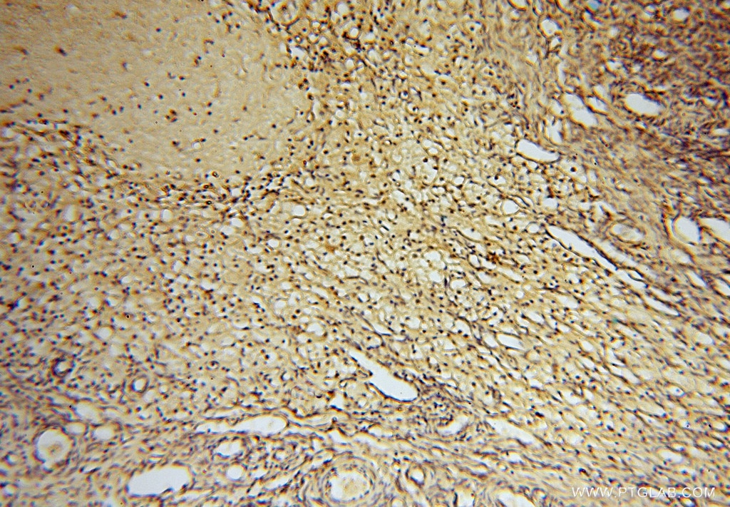 Immunohistochemistry (IHC) staining of human ovary tissue using HDAC2-specific Polyclonal antibody (16152-1-AP)