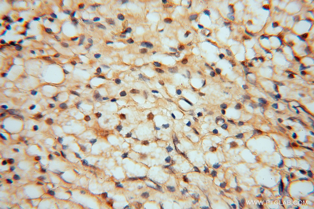 Immunohistochemistry (IHC) staining of human ovary tissue using HDAC2-specific Polyclonal antibody (16152-1-AP)