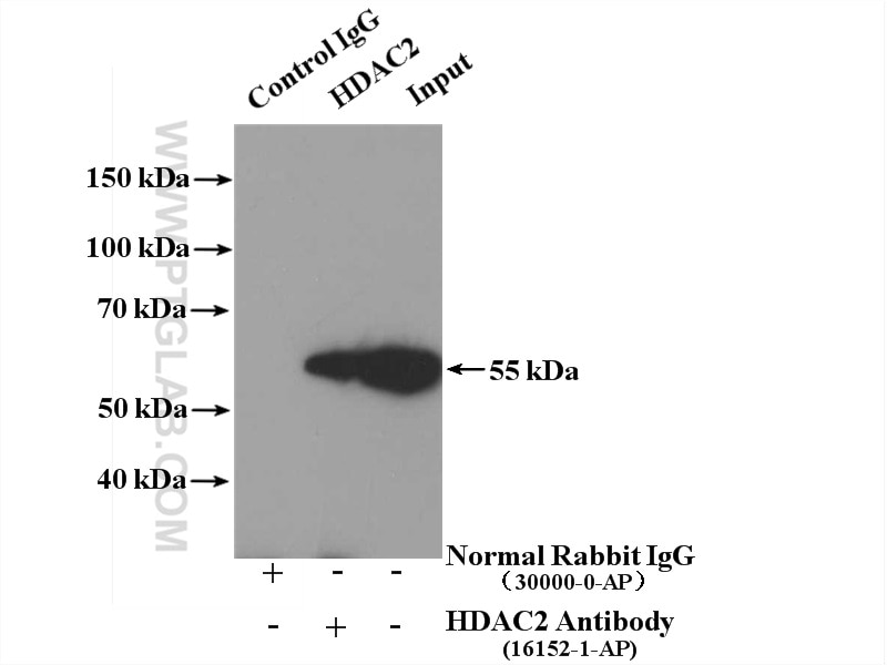 Immunoprecipitation (IP) experiment of A431 cells using HDAC2-specific Polyclonal antibody (16152-1-AP)