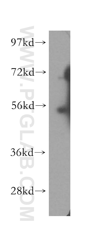 Western Blot (WB) analysis of A431 cells using HDAC2-specific Polyclonal antibody (16152-1-AP)