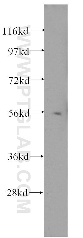 Western Blot (WB) analysis of human liver tissue using HDAC2-specific Polyclonal antibody (16152-1-AP)