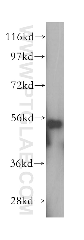 Western Blot (WB) analysis of HeLa cells using HDAC2-specific Polyclonal antibody (16152-1-AP)