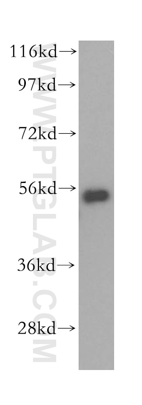 Western Blot (WB) analysis of HepG2 cells using HDAC2-specific Polyclonal antibody (16152-1-AP)