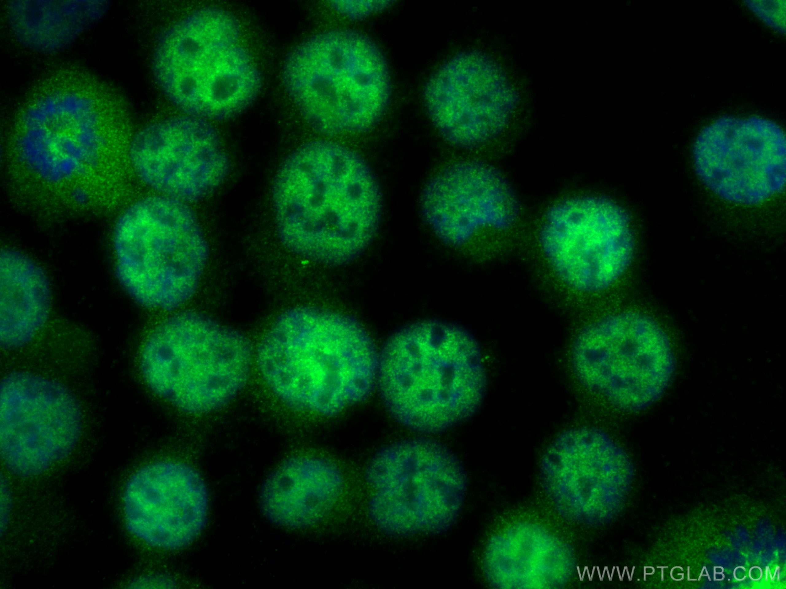 IF Staining of K-562 using 10255-1-AP