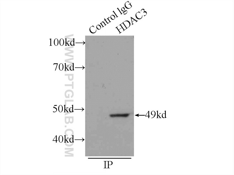 Immunoprecipitation (IP) experiment of A431 cells using HDAC3 Polyclonal antibody (10255-1-AP)