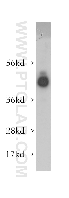 HDAC3