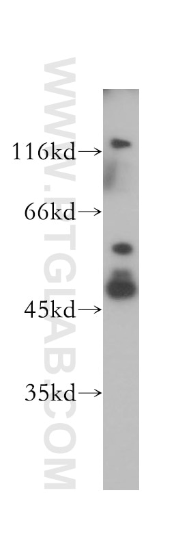 Western Blot (WB) analysis of HeLa cells using HDAC3 Polyclonal antibody (10255-1-AP)