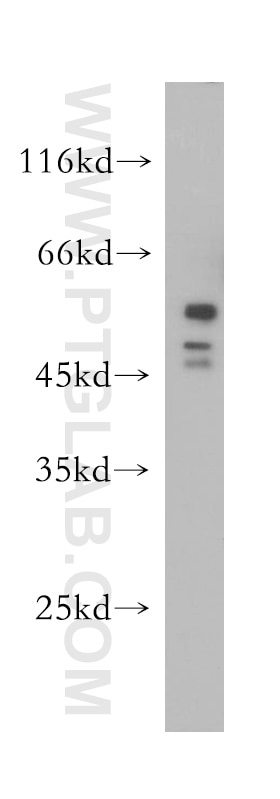 Western Blot (WB) analysis of A431 cells using HDAC3 Polyclonal antibody (10255-1-AP)