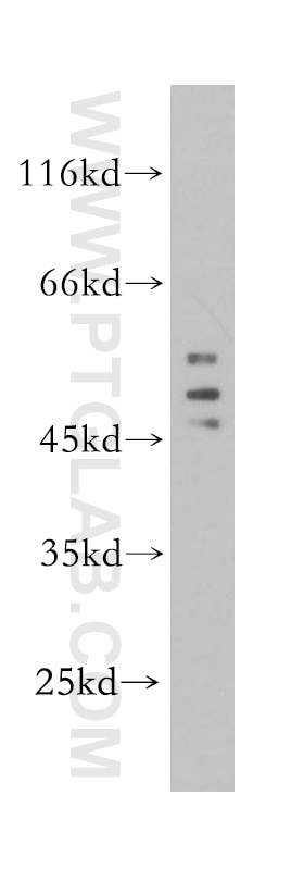 Western Blot (WB) analysis of HL-60 cells using HDAC3 Polyclonal antibody (10255-1-AP)