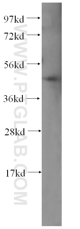Western Blot (WB) analysis of HEK-293 cells using HDAC3-specific Polyclonal antibody (16164-1-AP)
