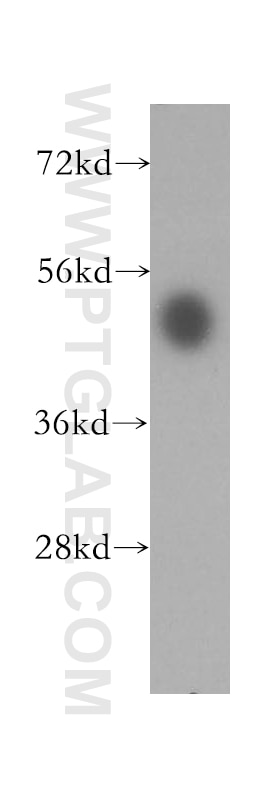 Western Blot (WB) analysis of human stomach tissue using HDAC3-specific Polyclonal antibody (16164-1-AP)