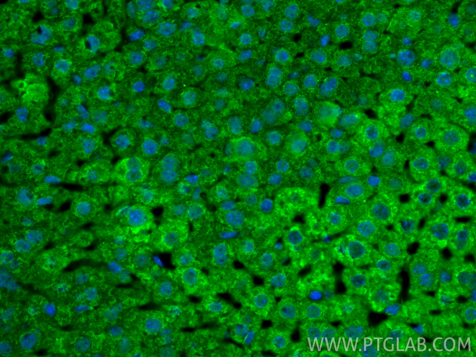 Immunofluorescence (IF) / fluorescent staining of mouse liver tissue using HDAC4 Polyclonal antibody (17449-1-AP)