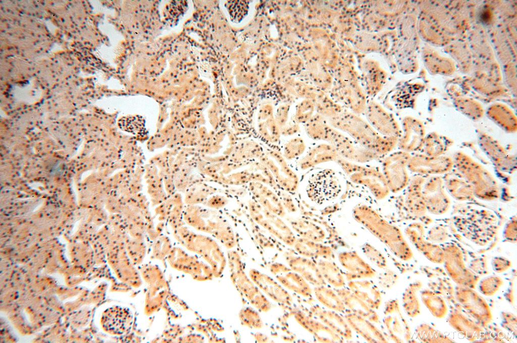 Immunohistochemistry (IHC) staining of human kidney tissue using HDAC4 Polyclonal antibody (17449-1-AP)