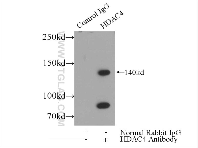 Immunoprecipitation (IP) experiment of HeLa cells using HDAC4 Polyclonal antibody (17449-1-AP)