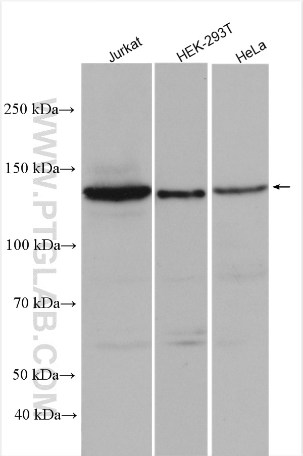 Western Blot (WB) analysis of various lysates using HDAC4 Polyclonal antibody (17449-1-AP)