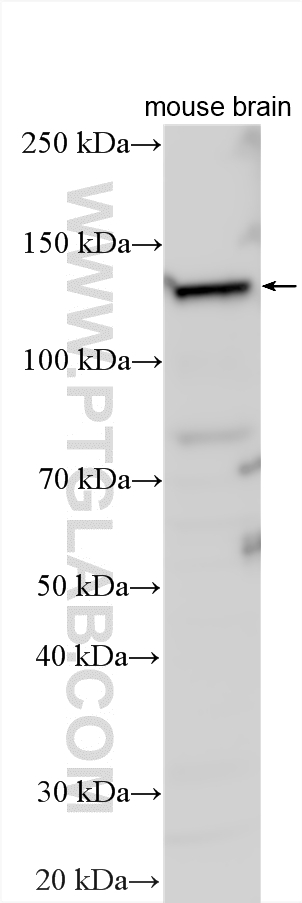 Western Blot (WB) analysis of various lysates using HDAC4 Polyclonal antibody (17449-1-AP)