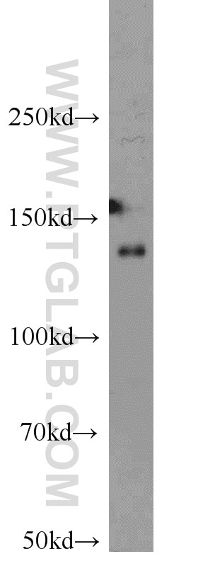 Western Blot (WB) analysis of HEK-293 cells using HDAC4 Polyclonal antibody (17449-1-AP)