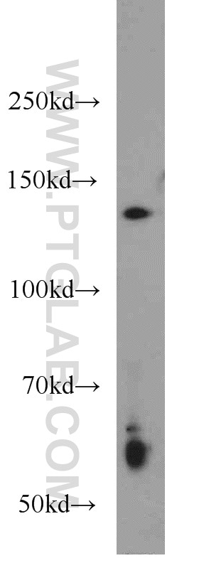 HDAC4