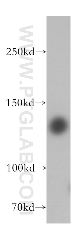 HDAC4 Polyclonal antibody