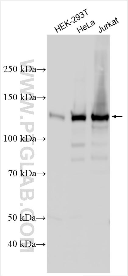 Western Blot (WB) analysis of various lysates using HDAC4 Polyclonal antibody (29252-1-AP)