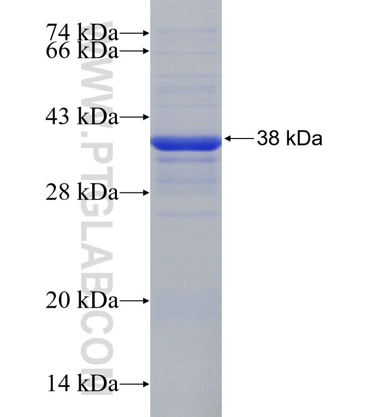 HDAC4 fusion protein Ag30752 SDS-PAGE