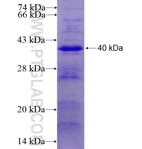 HDAC4 fusion protein Ag11345 SDS-PAGE