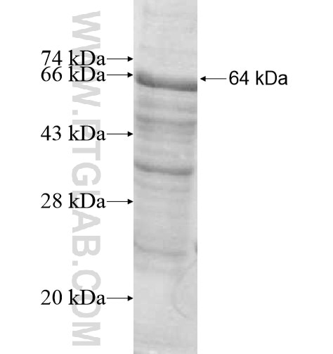HDAC4 fusion protein Ag11572 SDS-PAGE
