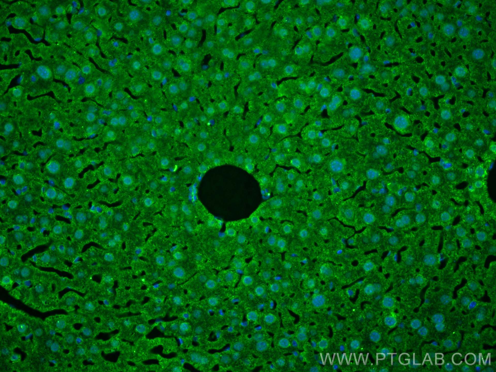 Immunofluorescence (IF) / fluorescent staining of mouse liver tissue using HDAC4-specific Polyclonal antibody (16165-1-AP)