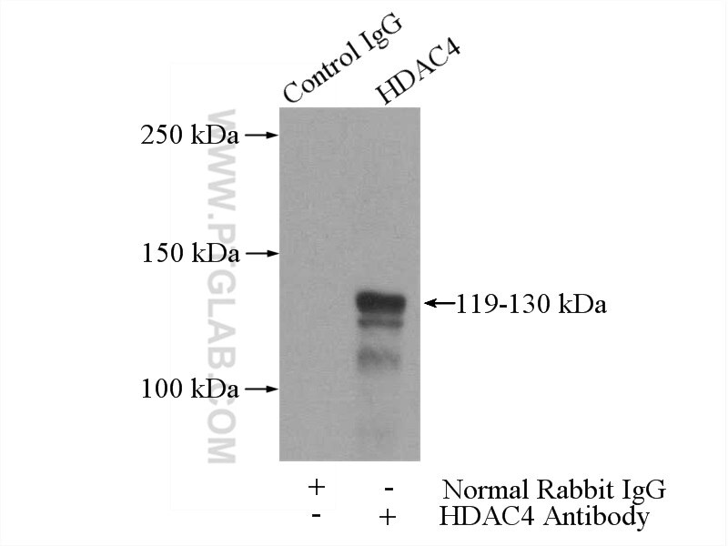 Immunoprecipitation (IP) experiment of HeLa cells using HDAC4-specific Polyclonal antibody (16165-1-AP)