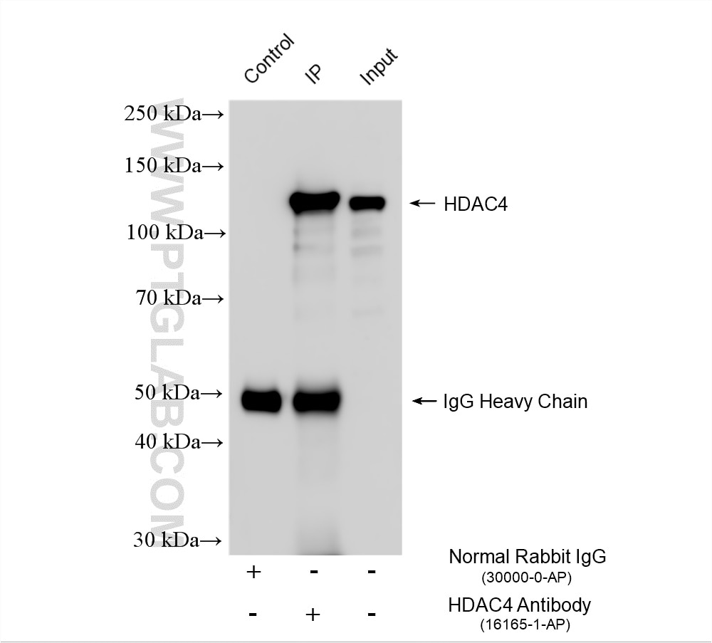 IP experiment of HeLa using 16165-1-AP Immunoprecipitation (IP) experiment of HeLa cells using HDAC4-specific Polyclonal antibody (16165-1-AP)