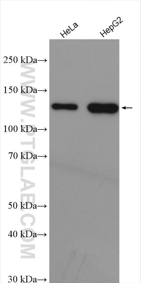 Western Blot (WB) analysis of various lysates using HDAC4-specific Polyclonal antibody (16165-1-AP)